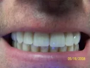 Smile Gallery Photo: After Treatment